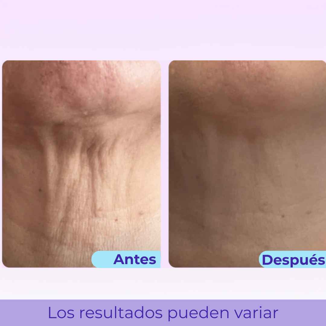 LiftNeck by Slinore — Crema Reafirmante para el Cuello