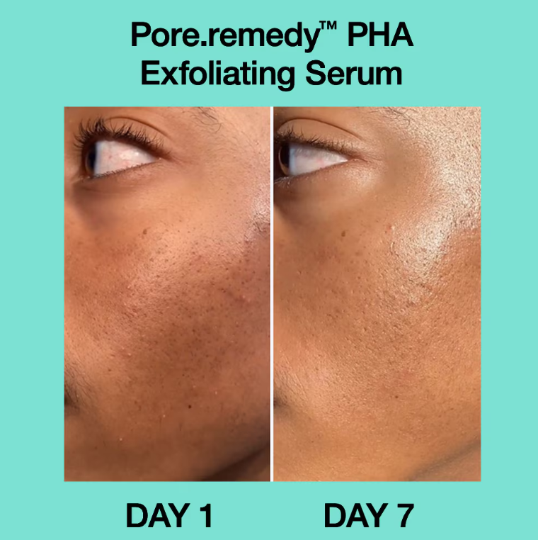 Dr.Jart+ - Pore Remedy PHA Exfoliating Serum (30ml)
