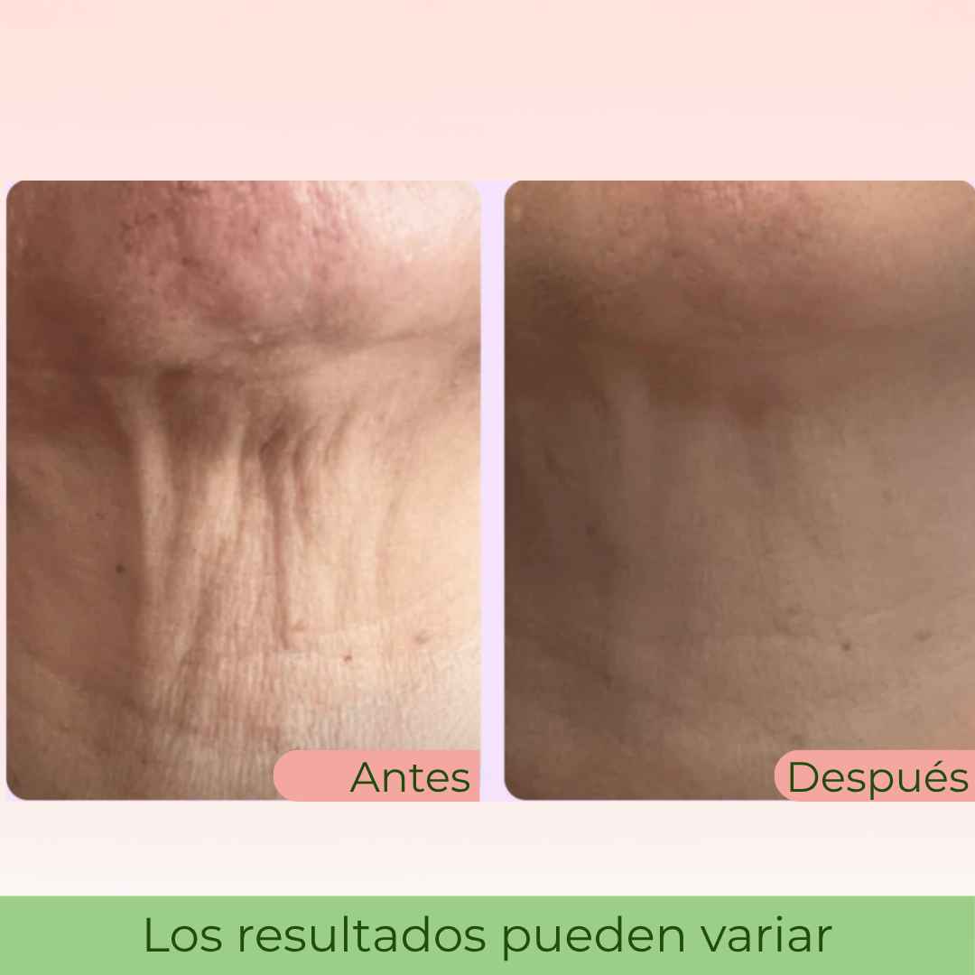 LiftNeck by Slinore — Crema Reafirmante para el Cuello