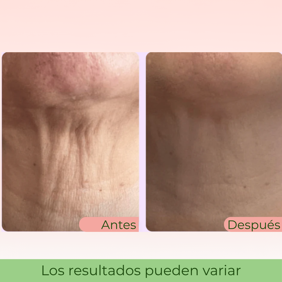 LiftNeck by Slinore — Crema Reafirmante para el Cuello