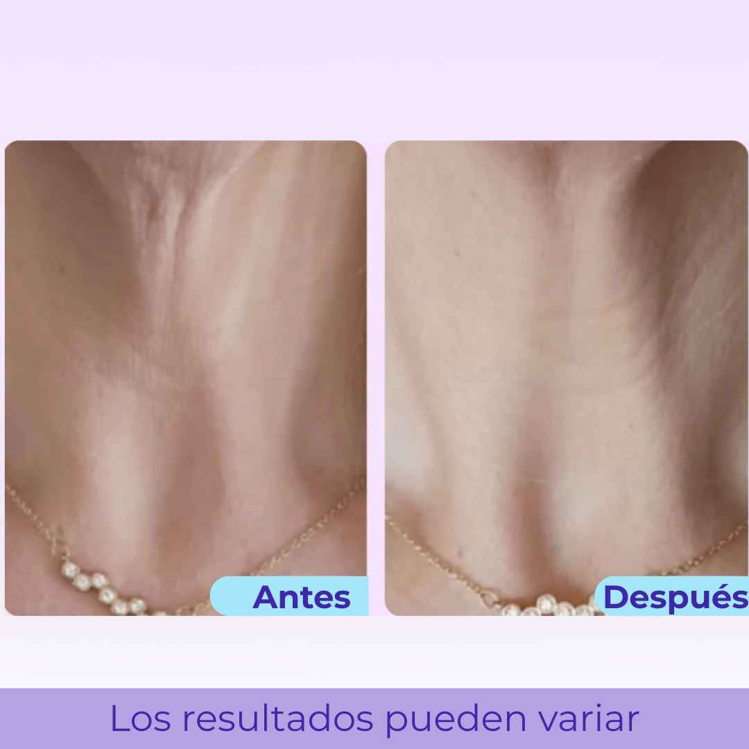 LiftNeck by Slinore — Crema Reafirmante para el Cuello
