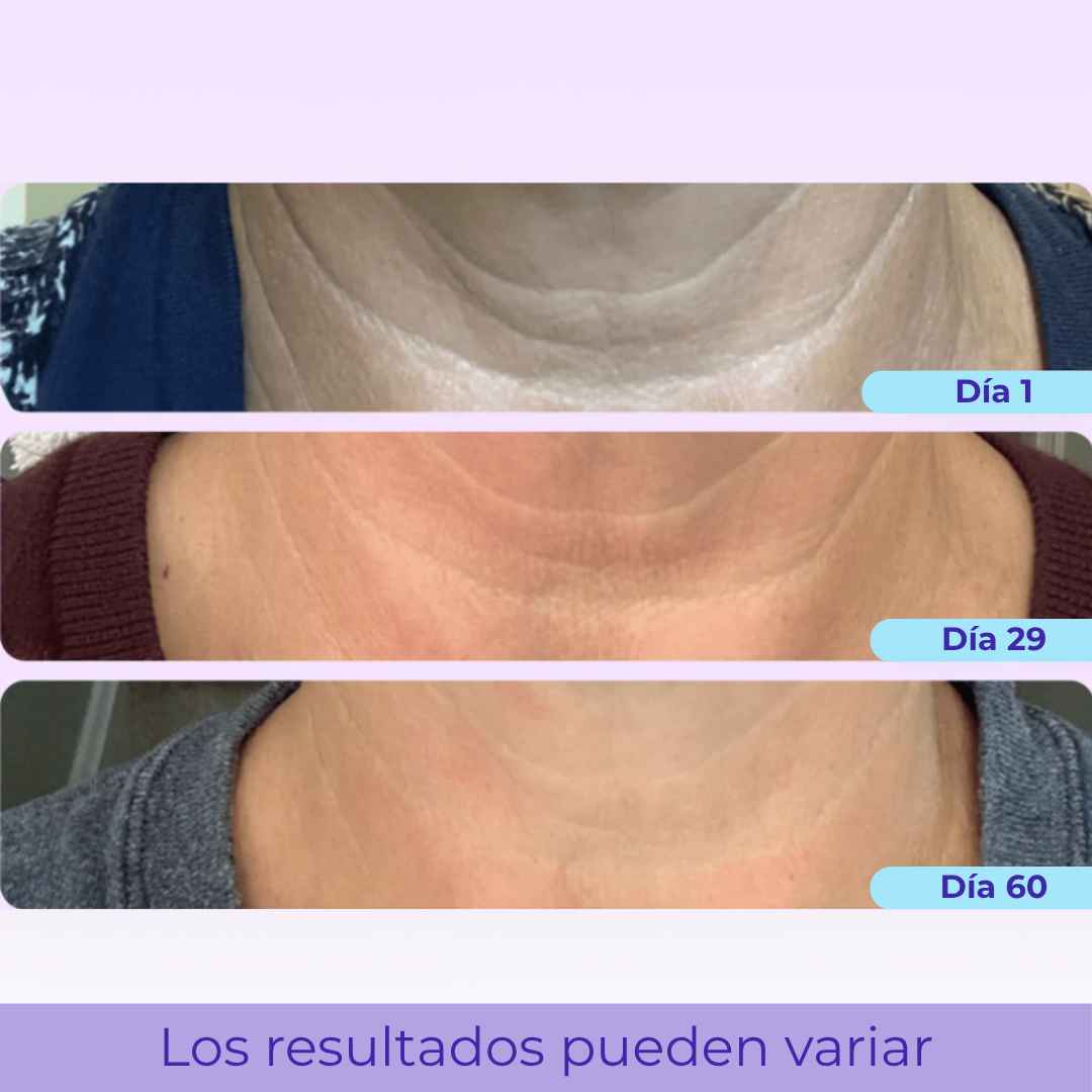LiftNeck by Slinore — Crema Reafirmante para el Cuello