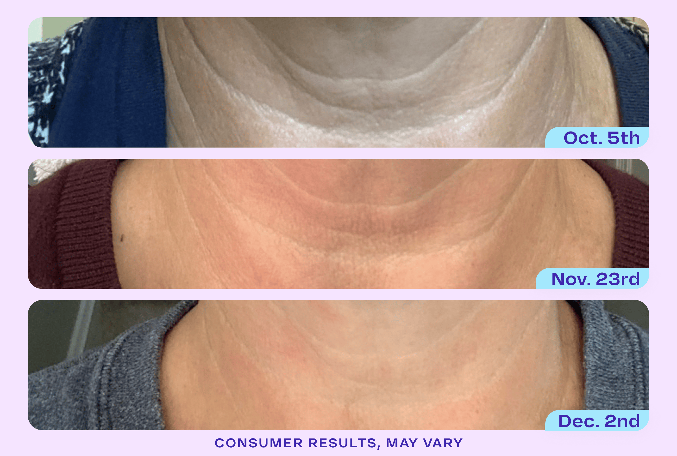 Tighten & Lift Neck Cream - NC41