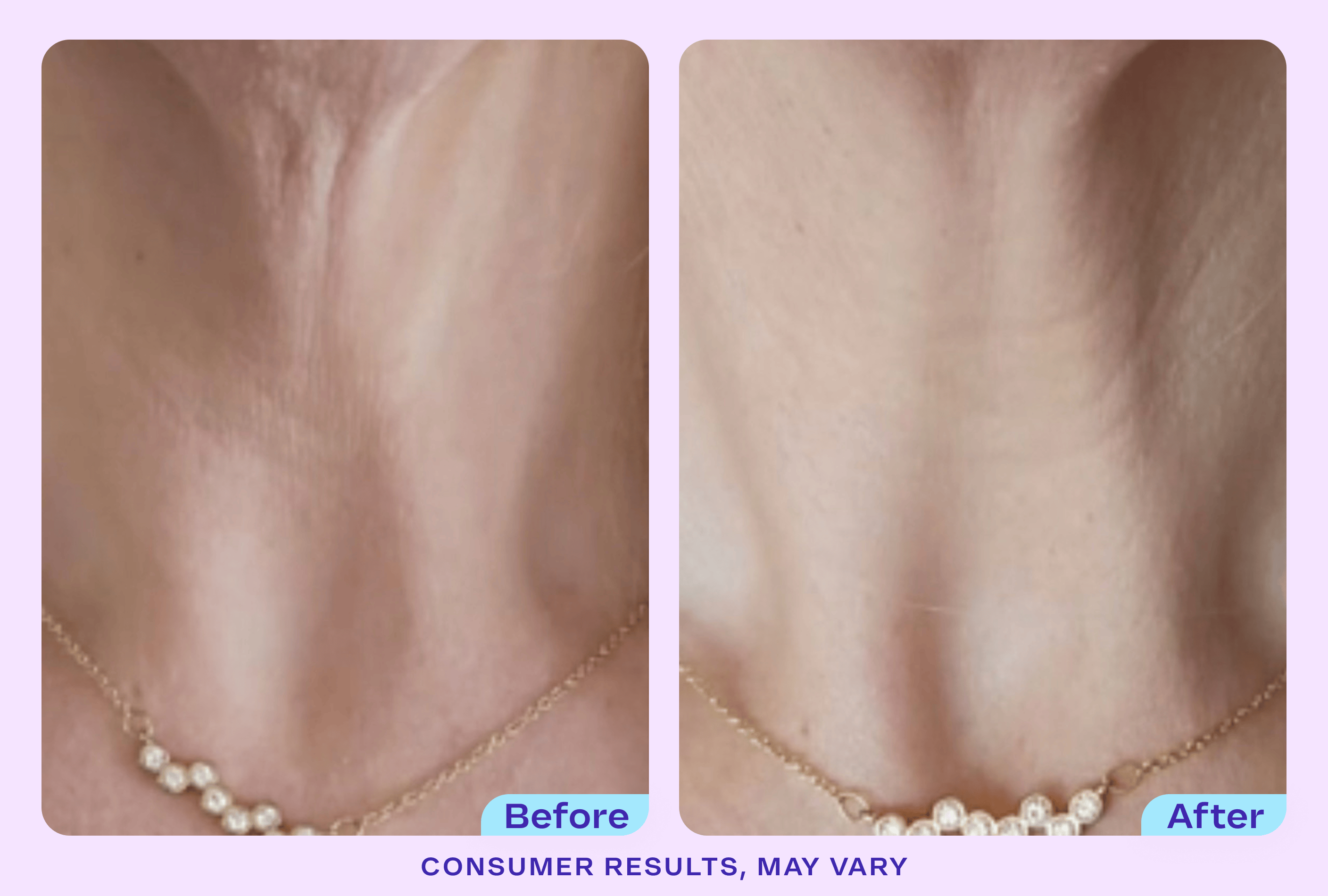 Tighten & Lift Neck Cream - NC41