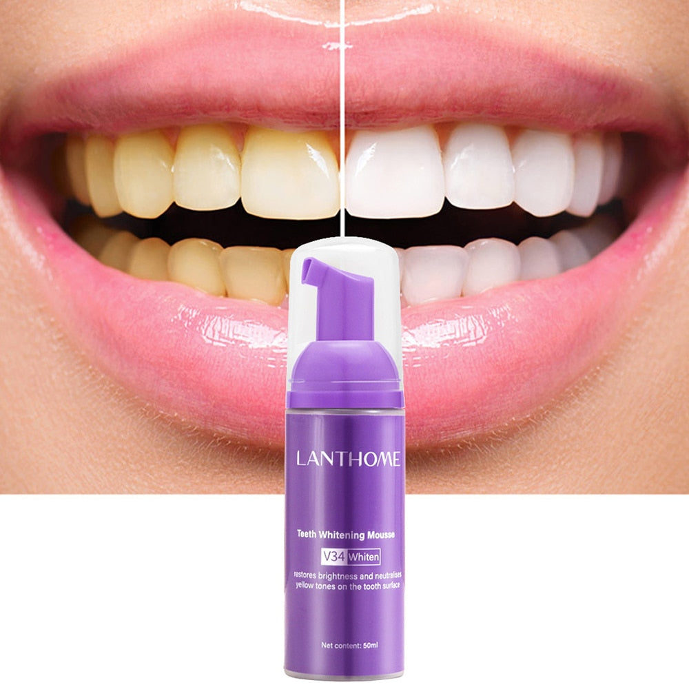 Blanqueamiento Dental LantHome Fresh White
