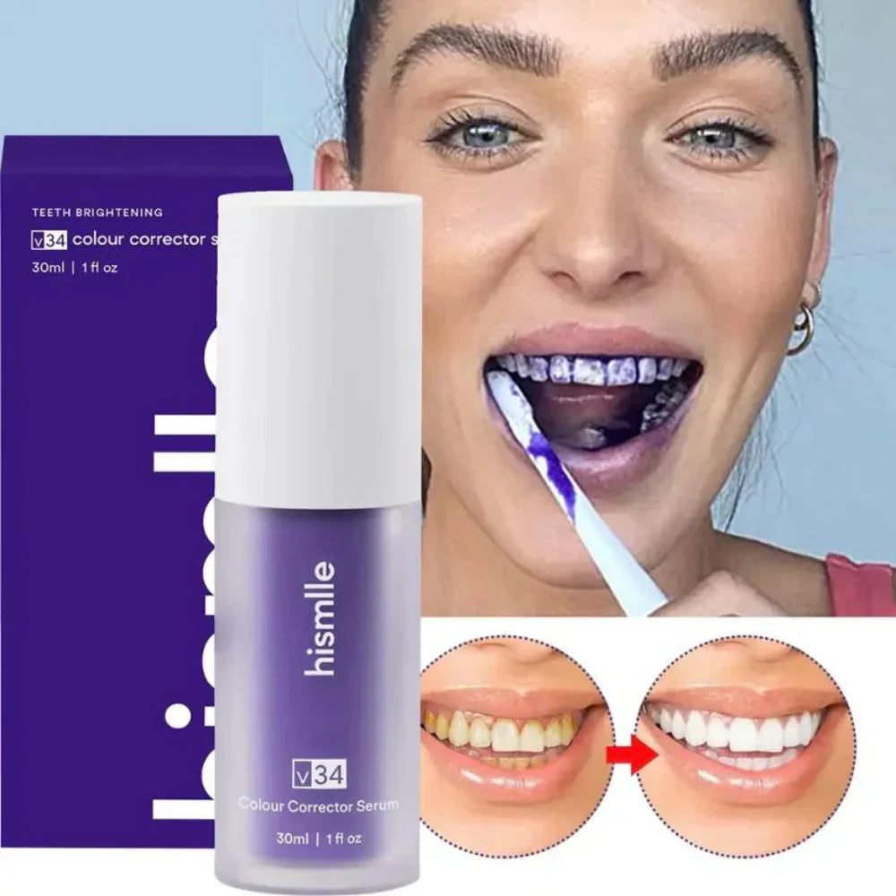Blanqueamiento Dental