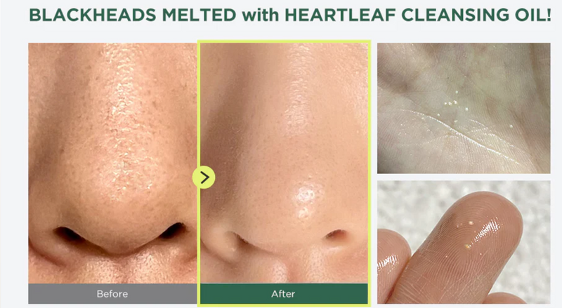 Anua - Heartleaf Pore Control Cleansing Oil (200ml)